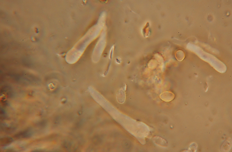 Phanerochaete avellanea  ?